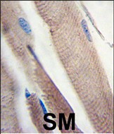 IHC-P - PI3KC3 Antibody (S851) AP1851j